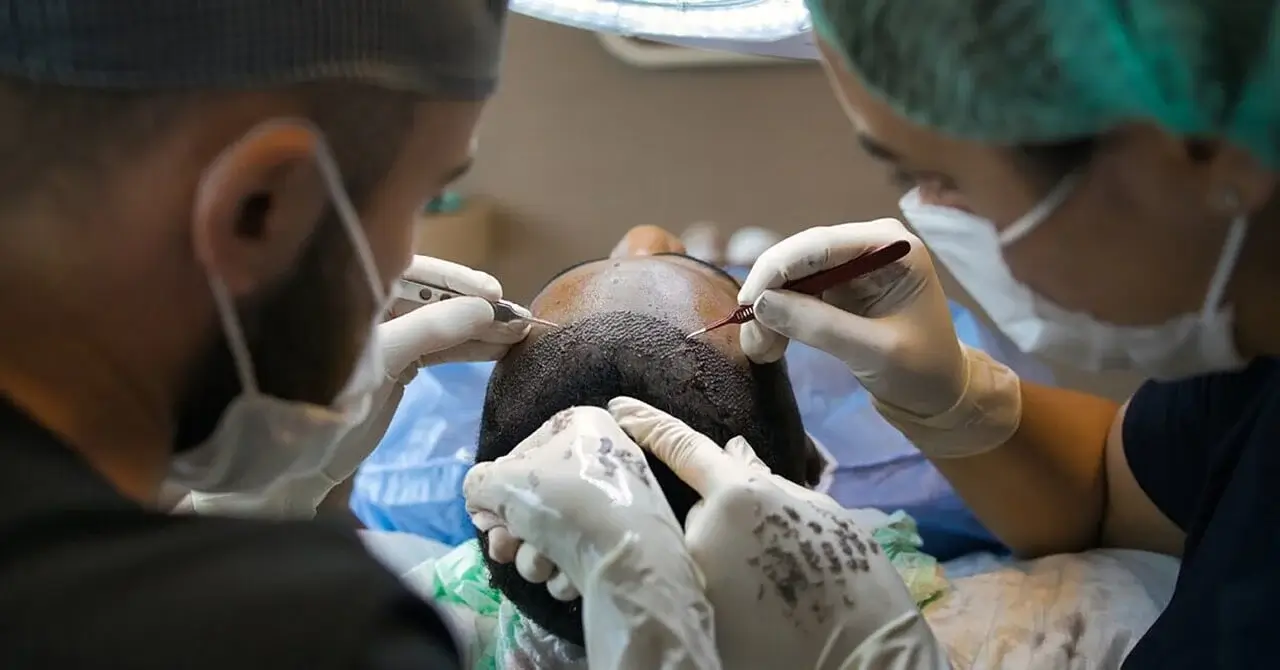 hair transplantation